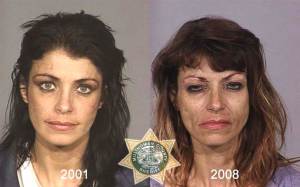 Before and After Drug Abuse